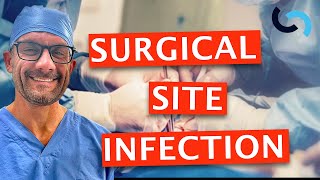 Surgical Site Infection - Diagnosis, Treatment and Prevention