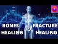 BONES Healing And Growth Frequency FRACTURE Healing Music 