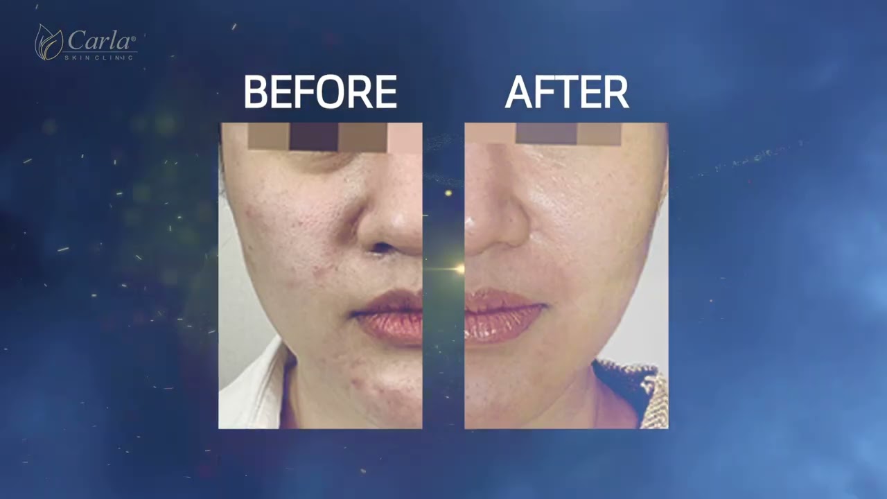 Welcome to Carla Skin Clinic