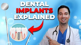 Dental Implant Procedure Simple Guide