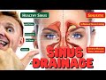 Sinus drainage in tiktok way ig way and yt way 