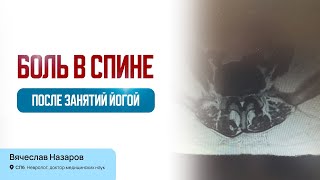 Боль в спине после занятий йогой. Йога. Лечение острой, хронической боли. Невролог, д.м.н. СПб.