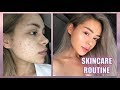 Skincare routine I How I cleared up my skin