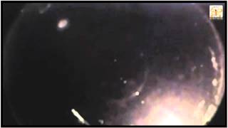 Fireball! A Fireball Lit Up Southeastern Sky On 6-29-2015