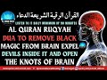 Quran Ruqyah Dua To Remove Black Magic From Brain Expel Devils Inside It And Open The Knots Of Brain