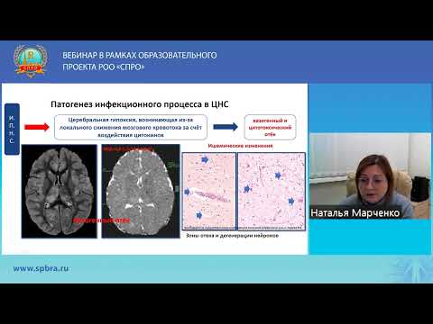 ВЕБИНАР «НЕЙРОРАДИОЛОГИЯ В ПЕДИАТРИЧЕСКОЙ ПРАКТИКЕ»