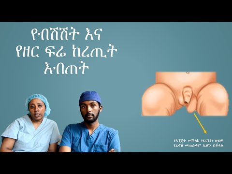 ቪዲዮ: ብቃት በሌለው የማህጸን ጫፍ እርግዝናን ለማራዘም 3 መንገዶች