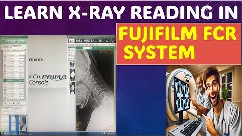 Fujifilm FCR System X-Ray Reading |  Radiology #medicos1k86 #radiology #xray #fuji #video #disease