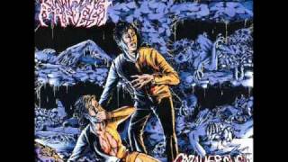 Cardiac Arrest - Out from the Womb... a Freak