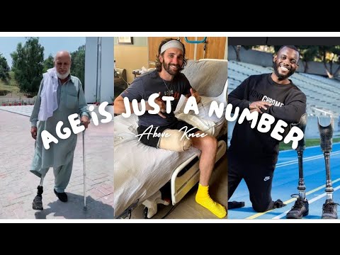 Taking Steps Forward: The Journey of Transtibial Amputees with Prosthetic Limbs