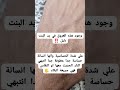 انتبهي من البنت اذا وجدتي في يدها هذه العروق معلومات اكسبلور 