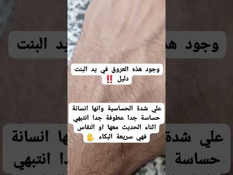 انتبهي من البنت اذا وجدتي في يدها هذه العروق معلومات اكسبلور