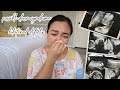 CONGENITAL ANOMALY SCAN KAY BABY #3 - anneclutzVLOGS