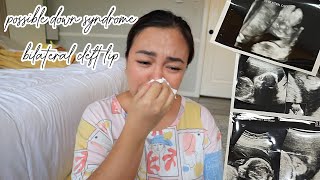 CONGENITAL ANOMALY SCAN KAY BABY #3 - anneclutzVLOGS