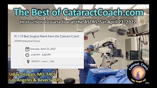 Cataractcoach Instructional Course At The Ascrs Meeting April 23, 2022