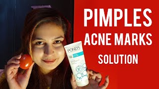 Remove Acne & Pop-up Pimples Naturally Overnight at Home screenshot 1