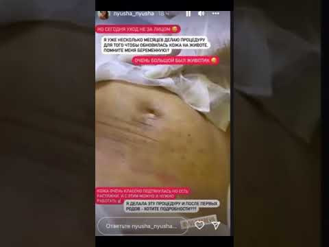 «Зрелище не для слабонервных»: