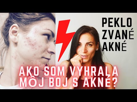 Video: Top 5 Produktů Na Akné Na Těle A Tváři