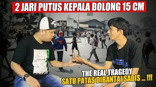KEHILANGAN 2 JARI KEPALA PENUH JAITAN || DIKEPUNG HANTU DARAT (TILE XDR)