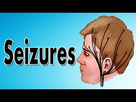 Epilepsy - Partial Seizures and Generalized Seizures (Causes, Symptoms, and Treatment)