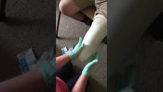 How To: Transtibial Cast screenshot 4