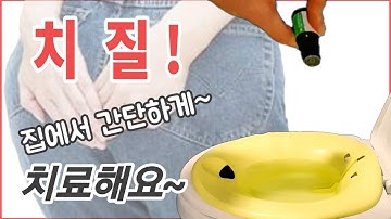 치질 있으신분~~수술 하지않고도 집에서 간단하게 치료할 수 있어요 !