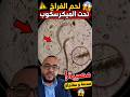 لحم الفراخ تحت الميكروسكوب مصيبة لا يتخيلها أحد الله يرحمك د ضياء العوضي دويتو اكسبلور 
