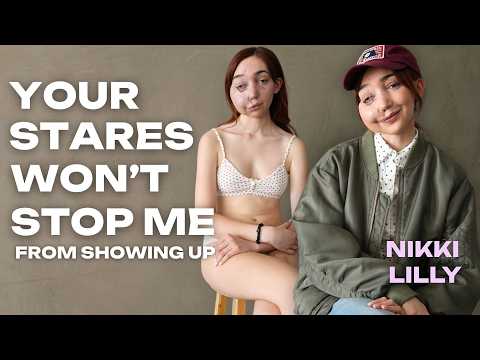 I Could Have Disappeared. I Ended Up at the Oscars: Nikki Lilly