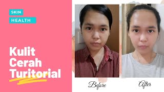 Kulit Cerah, Bisa V Shape, dengan Silviang- Cara Pakai Silviang KK Indonesia screenshot 5