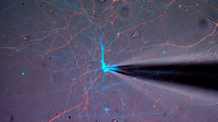 Investigating Therapies for Genetic Epilepsy with ...