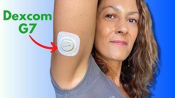 Dexcom G7 UPDATED Review - What I Learned After 2 Years of Use