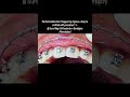 Perfect smiles don’t happen by chance—they’re crafted with precision! ✨ At Sure Align Orthodontix