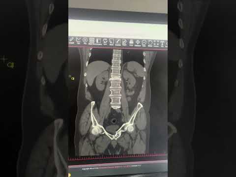 تشخیص پزشکی اورژانس بیمار بیمارستان   