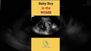 Baby Boyin the WOMB Tag your husband in this video ❤women baby pregnancy pregnant birth babies