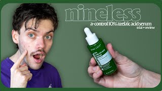 nineless a-control 10% azelaic acid serum | trial + review