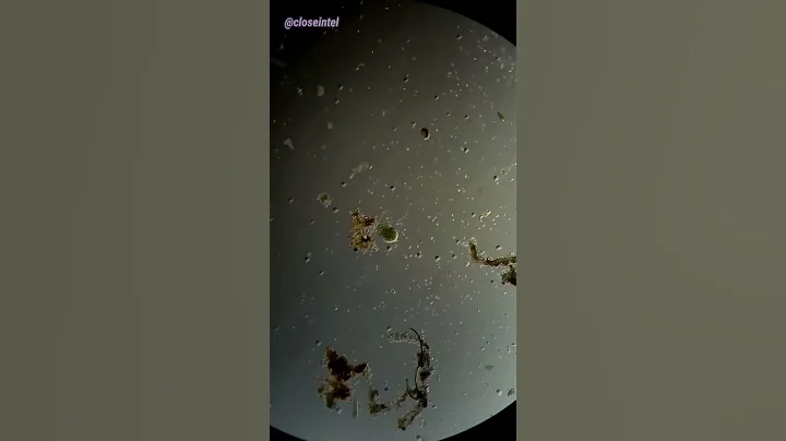 Cell Explodes Under Microscope (Hydrogen Peroxide vs Germs)