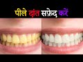 How to Whiten Yellow Teeth in Photoshop in Hindi | Yellow Teeth Solution
