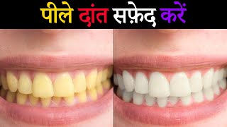 How to Whiten Yellow Teeth in Photoshop in Hindi | Yellow Teeth Solution