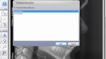 08  Import Tracing Tutorial Video For OrthoVision