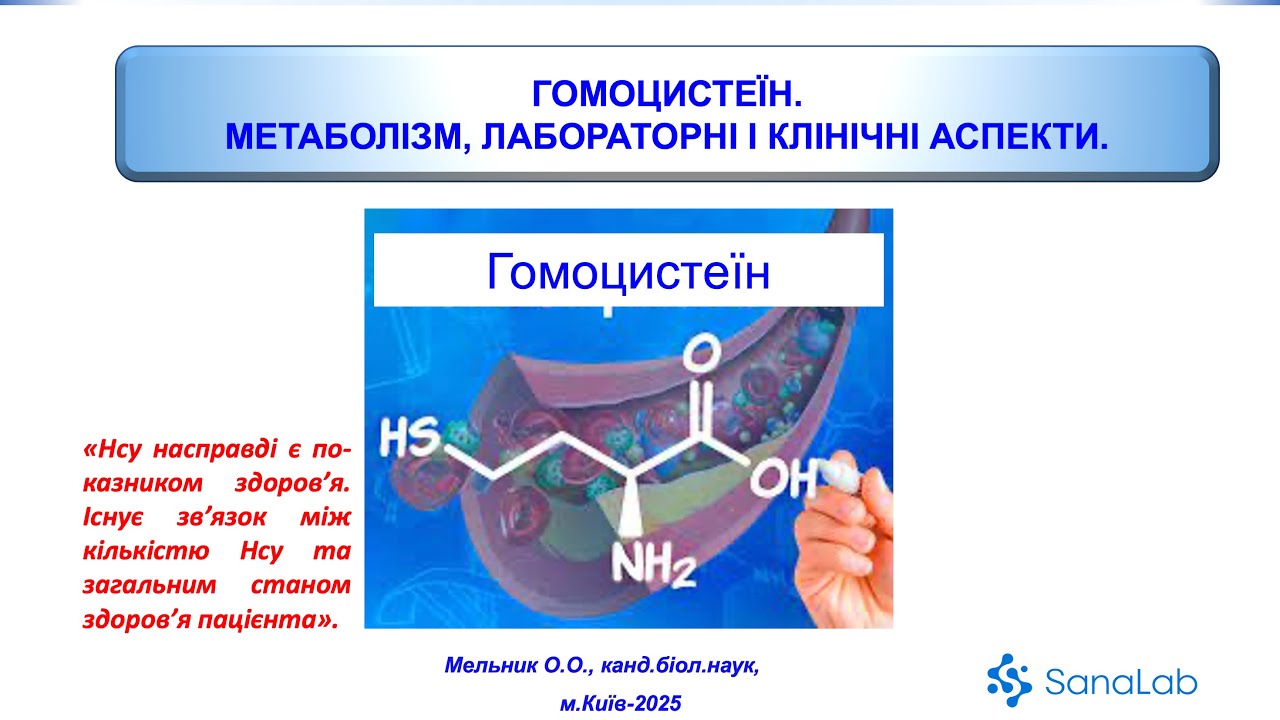 Гомоцистеїн. Метаболізм, лабораторні і клінічні аспекти