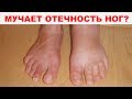 10 САМЫХ ЭФФЕКТИВНЫХ народных способов как избавиться от отеков ног. Средства проверенные годами