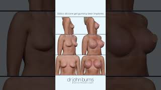 550cc A to D Breast Augmentation | Top Plastic Surgeon-Dr. John Burns A To C Cup Breast Implants Getting The Size Right Dr John Burns