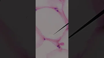 Como se originam os triglicerídeos armazenados nos adipócitos?