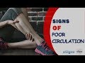 10 Signs of Poor Circulation