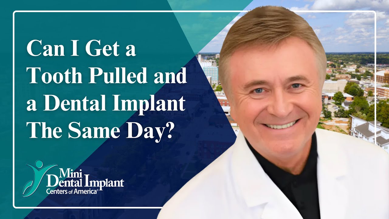 Can I Get a Tooth Pulled and a Dental Implant The Same Day? | Dental Implants in Springfield, MO