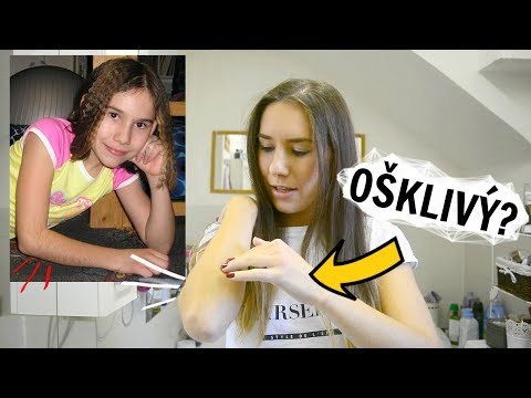 Video: Jak vyléčit rybí oko: 7 kroků (s obrázky)