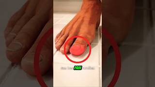 Why Stubbing Your Toe Hurts SO MUCH 😭