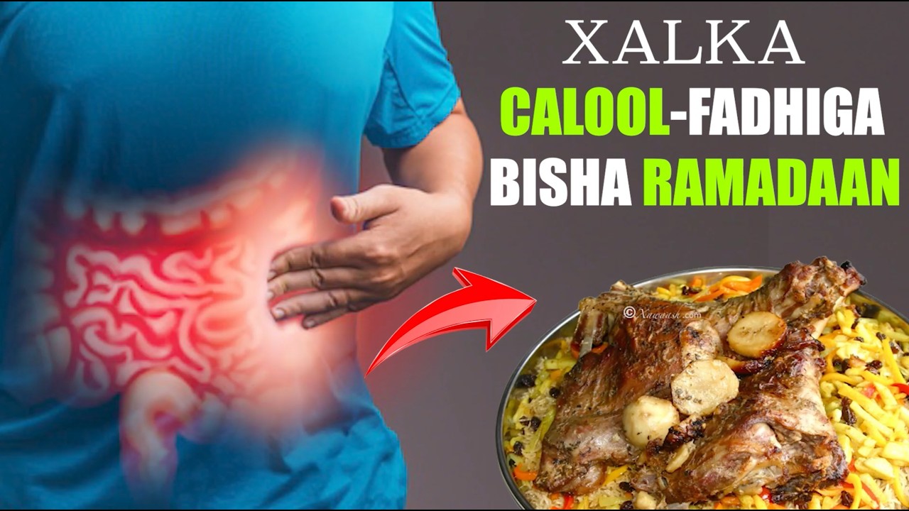 Mala Dhibantahay Calool-Xiranka (Calool-fadhiga) Bilaha Ramadaan?