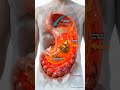 Stomach On Fire vs. Stomach at Peace #healthyeating