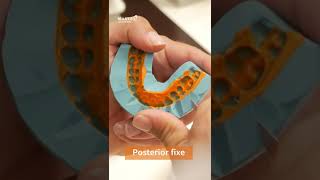 CAD-CAM Course With Dr.Anas Aloum